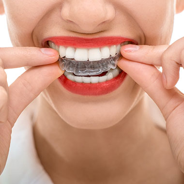A person wearing clear braces on their teeth while holding a finger near their mouth.