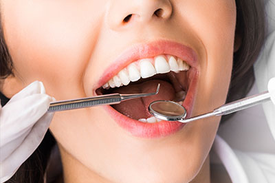 A woman with a wide smile undergoing dental treatment, wearing gloves and holding a drill, with a close-up view of her mouth and teeth.