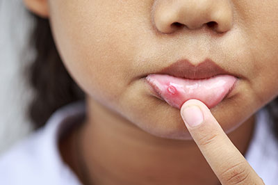 A young girl with acne is examining her skin with her finger, focusing on a red blemish.